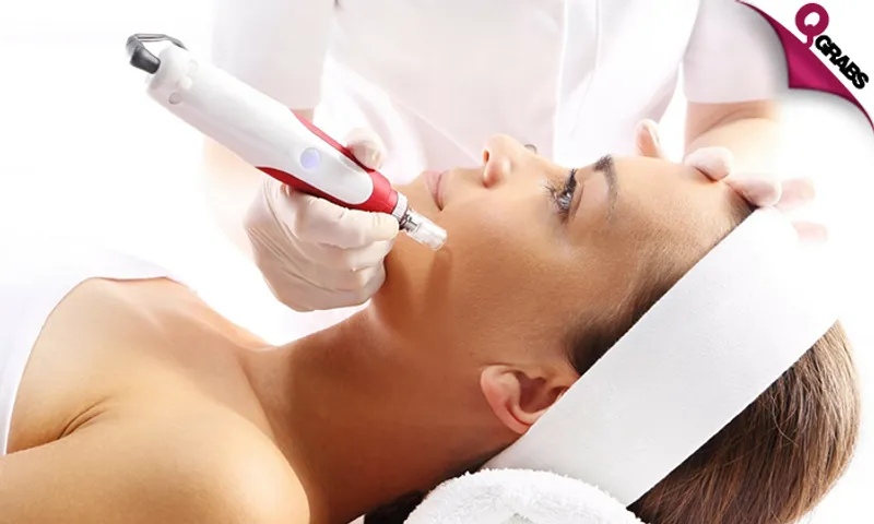Dermapen Treatments & More!